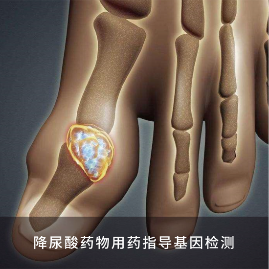 图片 降尿酸药物用药指导基因检测